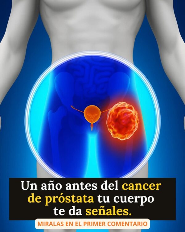Los cinco síntomas del cáncer de próstata que suelen pasar desapercibidos: no los ignore